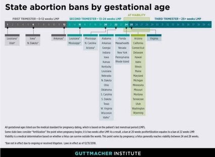 State abortion bans by gestational age